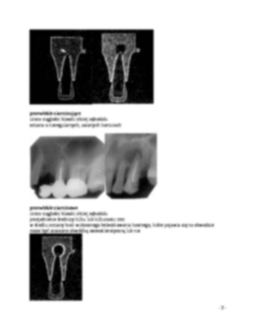 Wykład - Obraz rentgenowski okołowierzchołkowych zmian zapalnych - strona 2