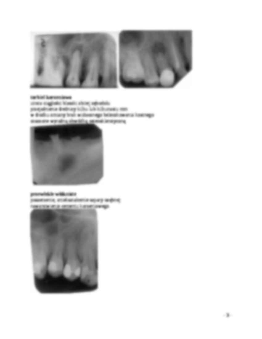 Wykład - Obraz rentgenowski okołowierzchołkowych zmian zapalnych - strona 3