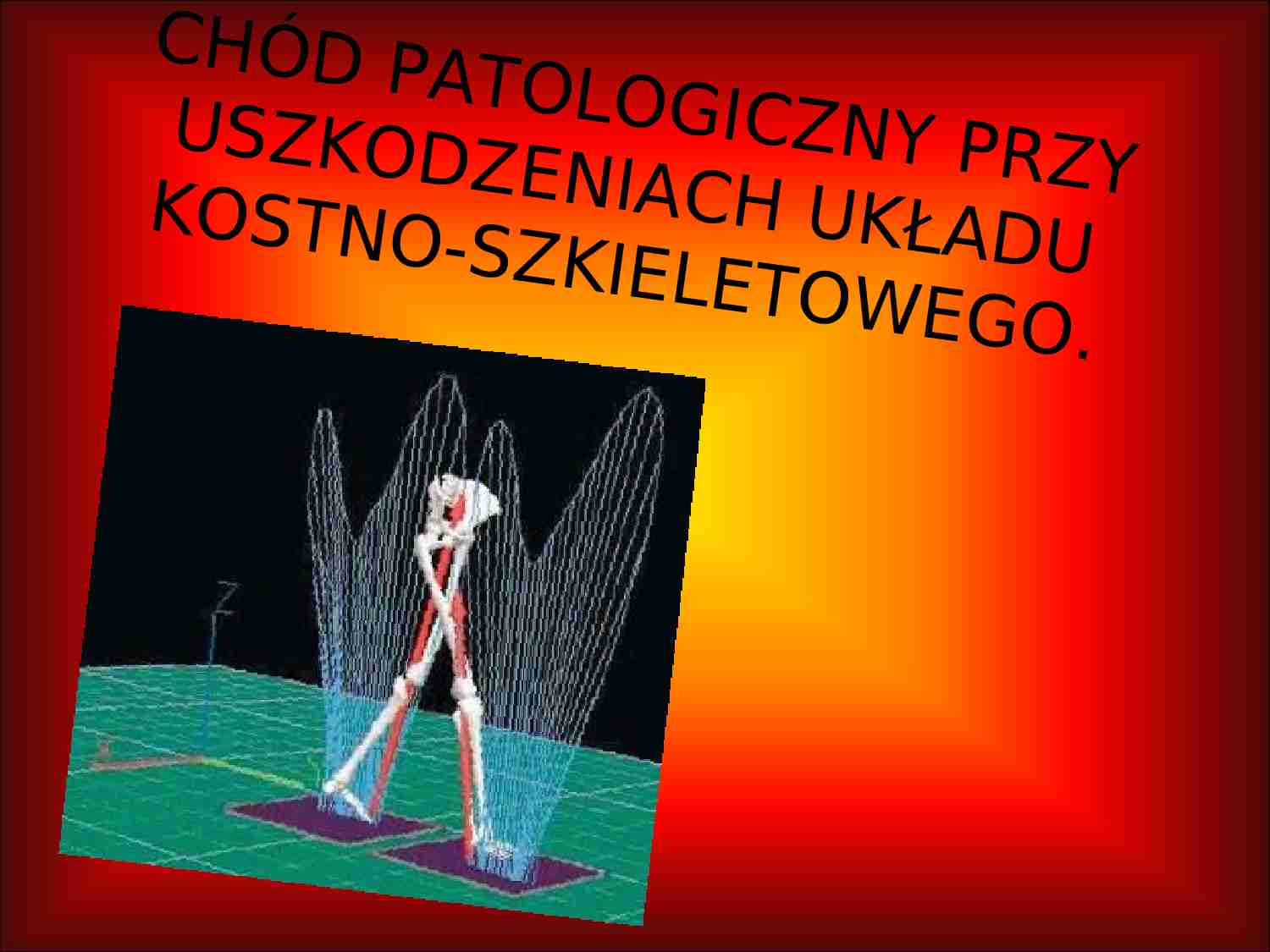 Chód patologiczny - uszkodzenia kostno-szkieletowe - strona 1