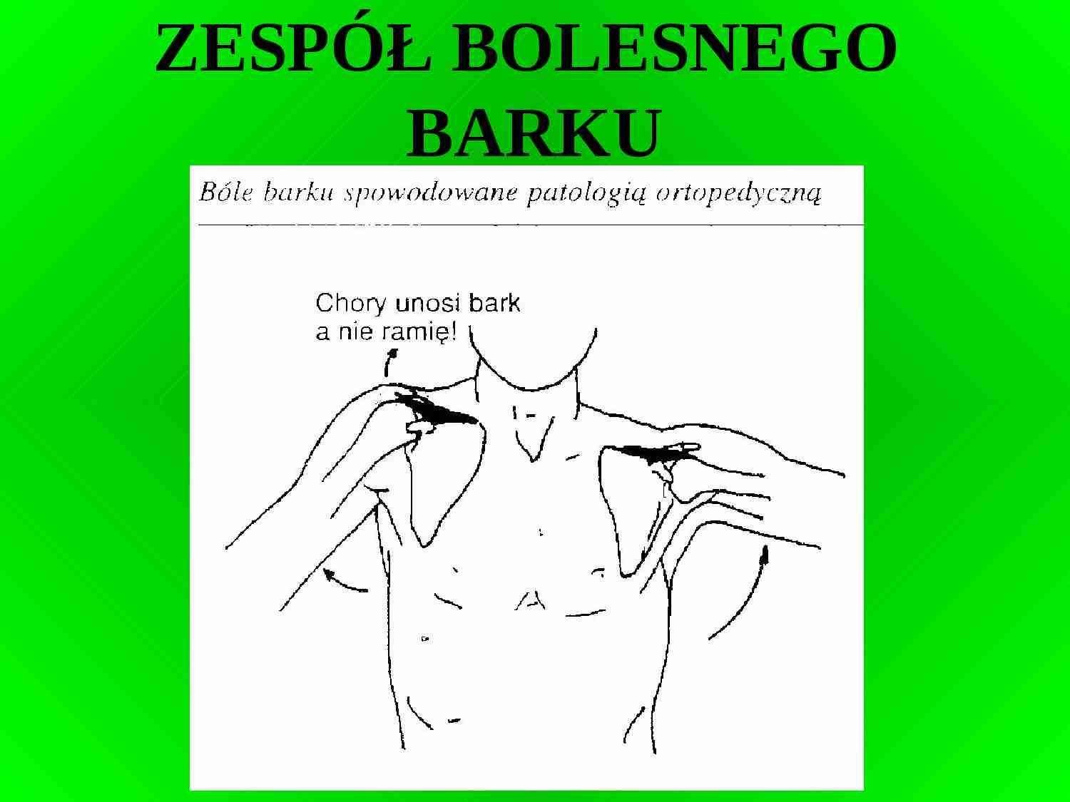Zespół bolesnego barku - strona 1