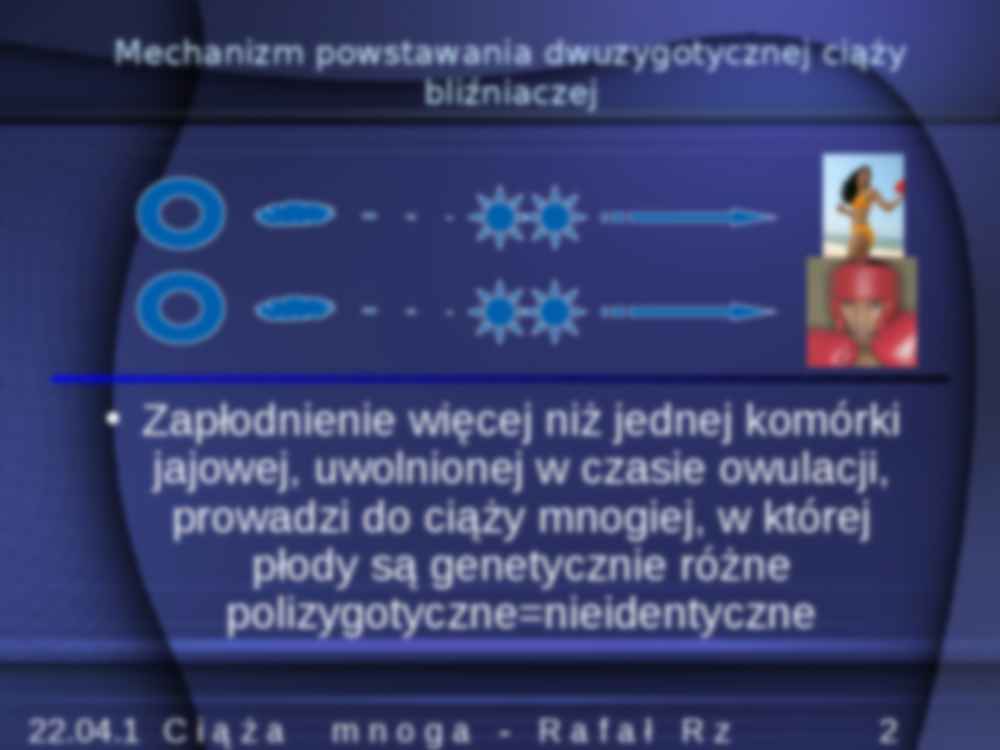 Ciąża mnoga- prezentacja - strona 2