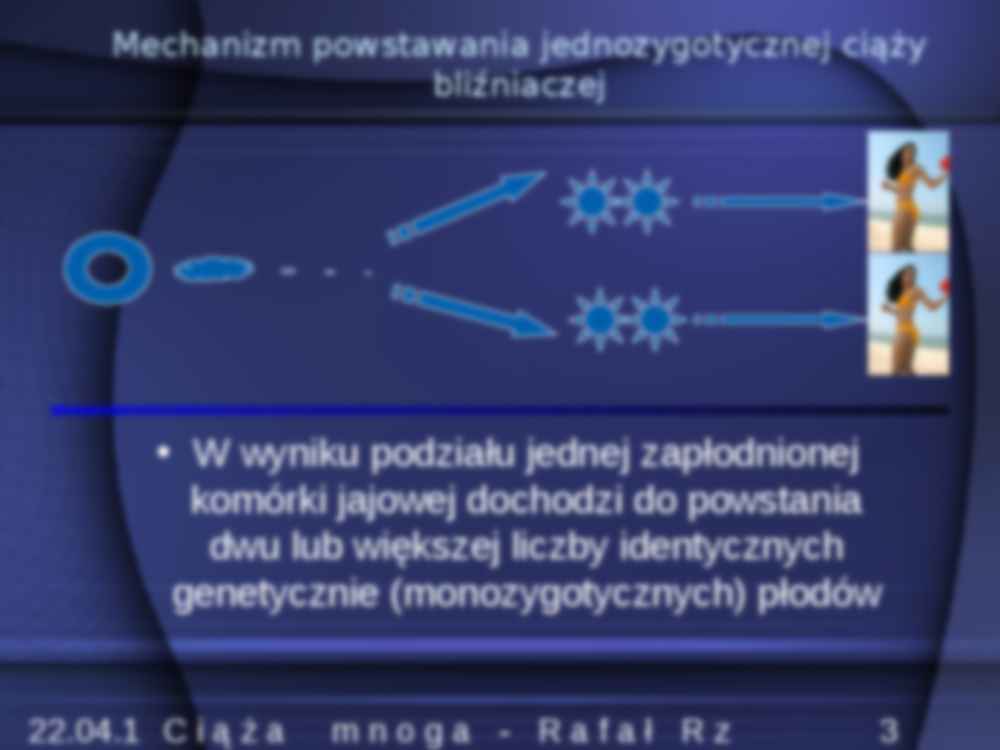 Ciąża mnoga- prezentacja - strona 3