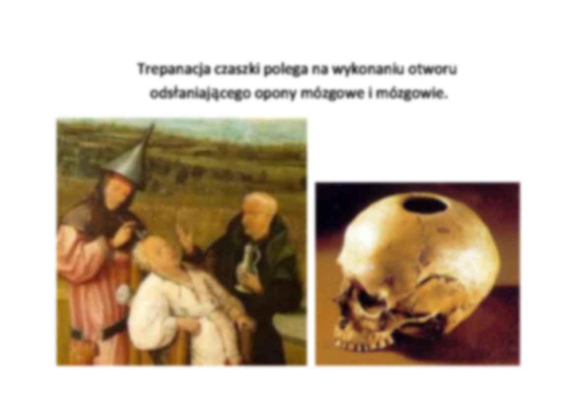 Trepanacja istereotaksja - strona 2