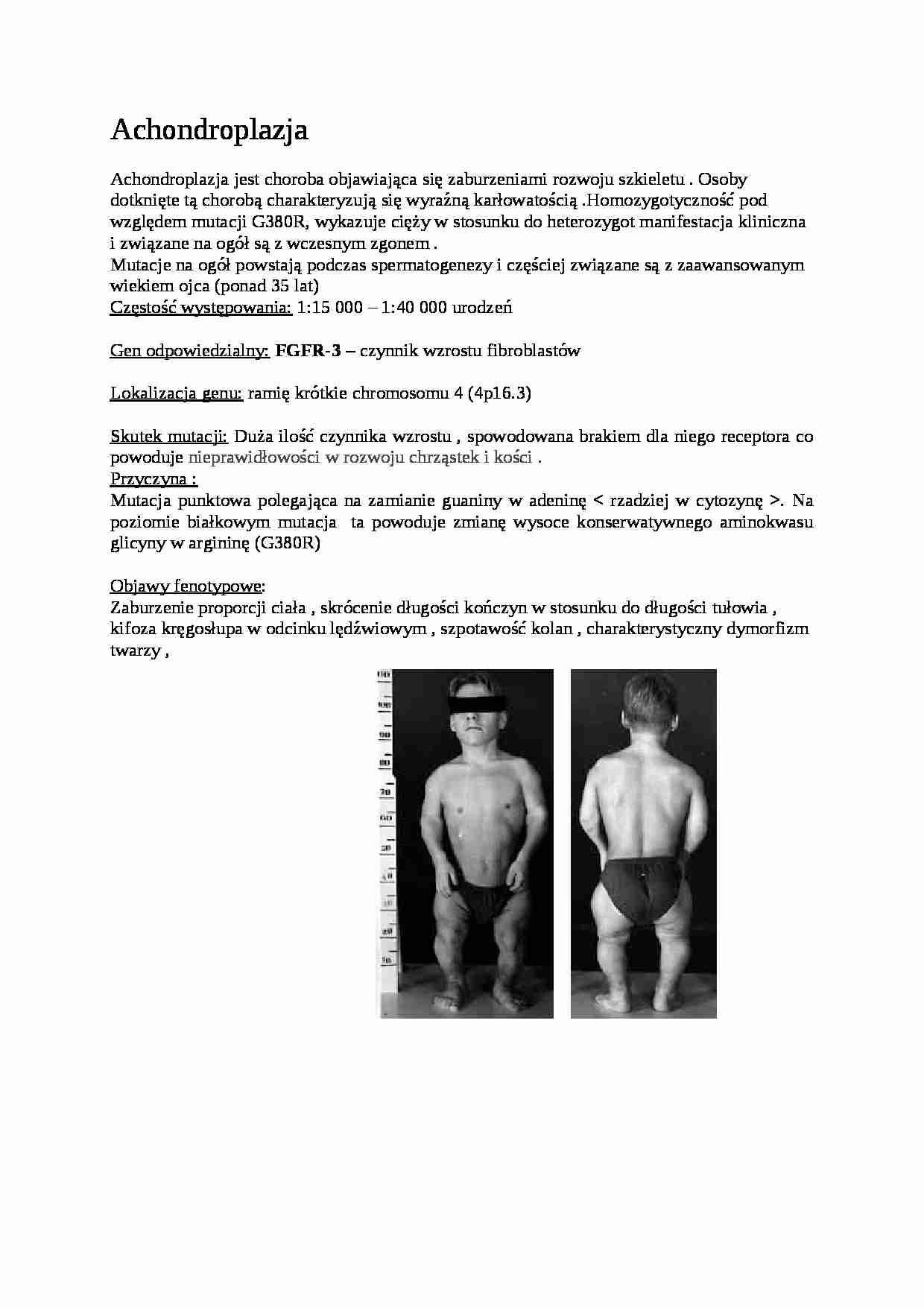 choroby genetyczne - Achondroplazja - strona 1