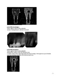wyklad-obraz-rentgenowski-okolowierzcholkowych-zmian-zapalnych