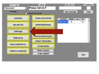 program-osteroware-pory-i-kanaly-kosci