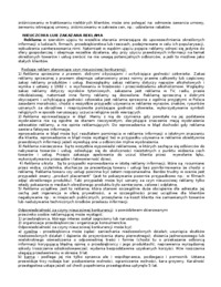 nieuczciwa-konkurencja