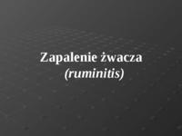 _w. 4 - Zap. _wacza, zatkanie ksi_g, syndrom Hofflunda, urazowe zap. czepca i otrzewnej